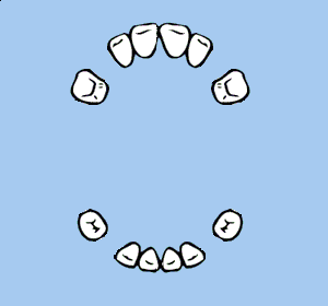 Acht Schneidez&auml;hne und vier Backenz&auml;hne.