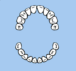 Alle 20 Milchz&auml;hne sind da und m&uuml;ssen gut geputzt werden.